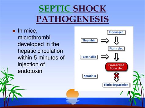 PPT SEPTIC SHOCK PowerPoint Presentation Free Download ID