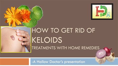 How To Get Rid Of Keloids Treatments With Home Remedies Natural Remedy For Keloids Hallow