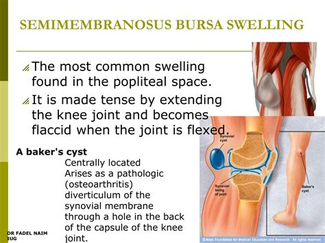 Ppt Bones Of The Leg Popliteal Fossa The Knee Powerpoint Presentation