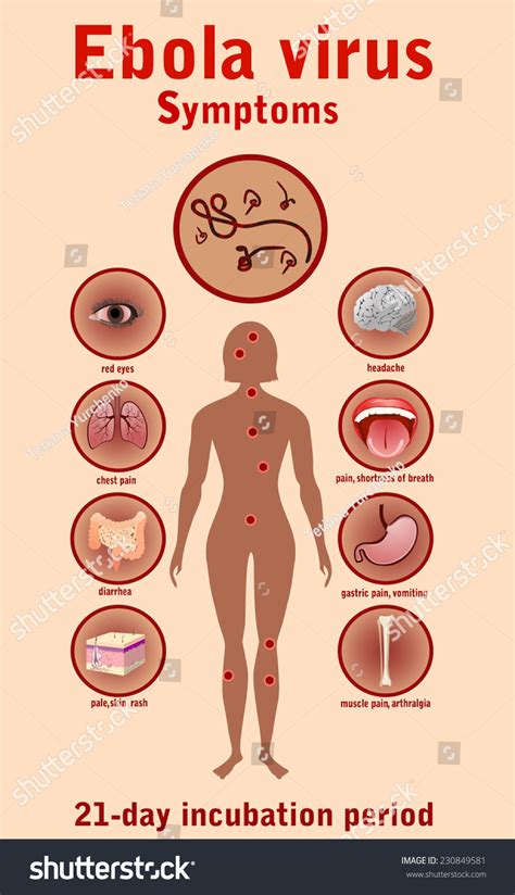 Neurologic manifestations of varicella zoster virus infections // curr neurol neurosci rep. Ebola Virus Disease. Symptoms. Stock Photo 230849581 ...