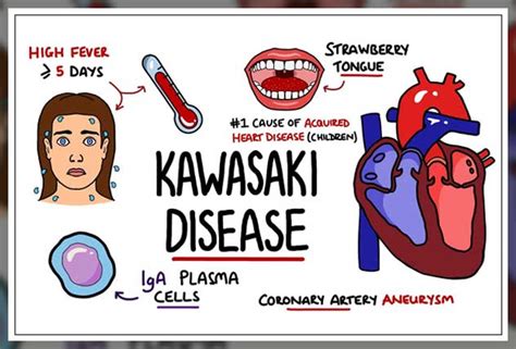 Kawasaki Disease Symptoms Causes And Treatment Dentist Ahmed