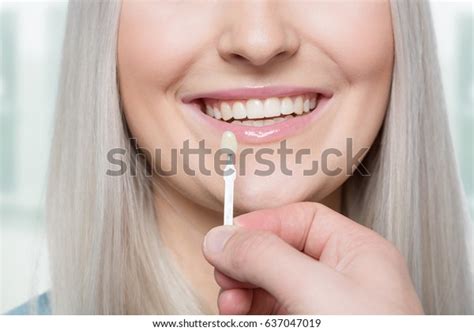 Using Shade Guide Mouth Check Veneer Stock Photo Edit Now 637047019