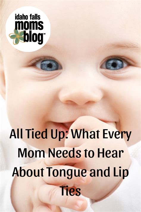One Moms Experience With Lip Ties And What She Learned Every Mom