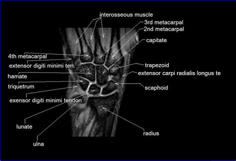 Foot Muscles Mri Anatomy Foot Anatomy Mri Coronal Images The Foot