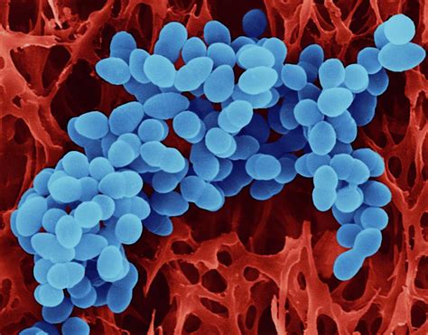 Staphylococcus Aureus 23 Photograph By Dennis Kunkel Microscopy