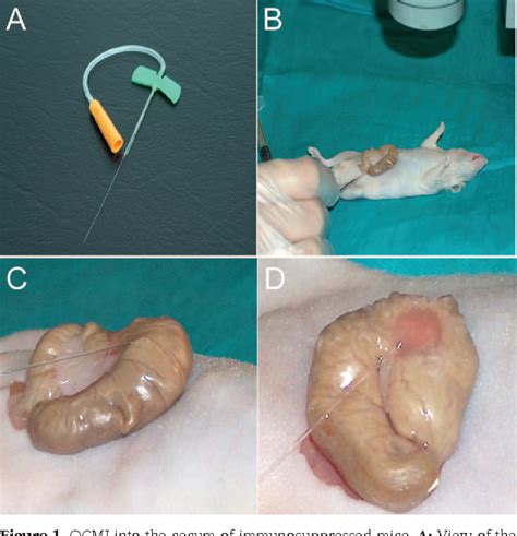 Figure 1 From Tumorigenesis And Neoplastic Progression Orthotopic