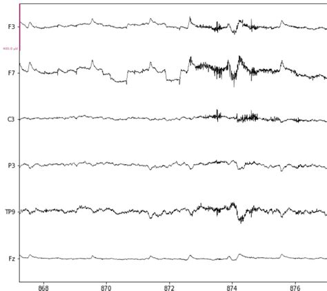 Artifacts In Eeg Data — Neural Data Science In Python