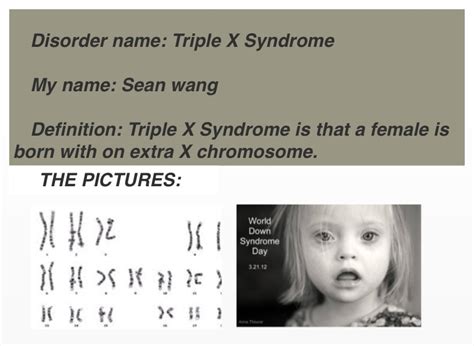 Triple X Syndrome Patient