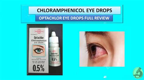 Chloramphenicol Eye Drops Optachlor Eye Drops Full Review Youtube