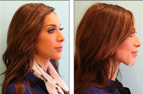 farrah abraham plastic surgery before and after photos celeblens