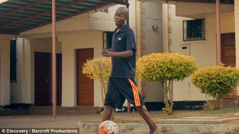 Kenyan Man Has 11lb Testicles Reduced So He Can Walk Daily Mail Online