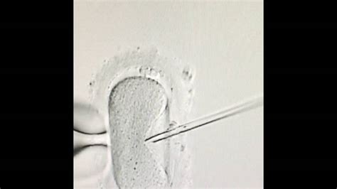 Advanced Fertility Centers Icsi Technique Intracytoplasmic Sperm Injection Youtube