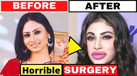 Bollywood Actresses Who Used Plastic Surgery To Look