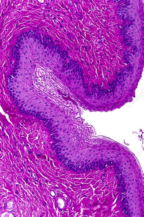 Stratified Squamous Epithelium Stock Image C0160534 Science