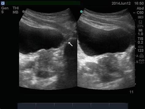 Ultrasound Imaging In Assessment Of The Male Patient With