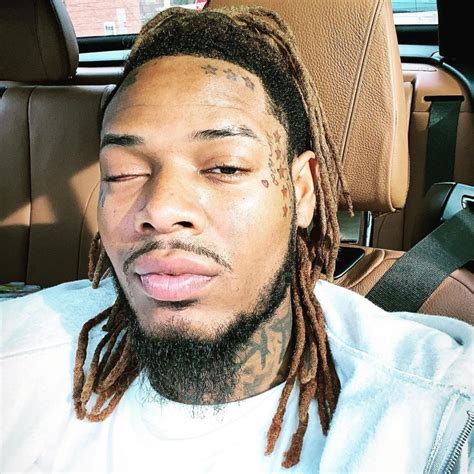 what happened to fetty wap s eye the us sun