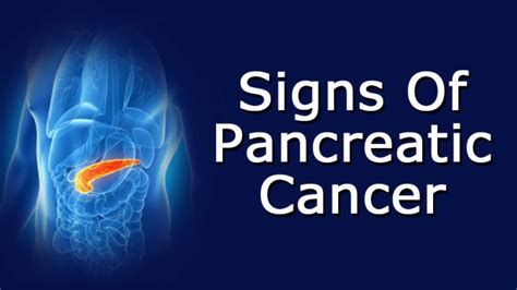 Signs Of Pancreatic Cancer Youtube