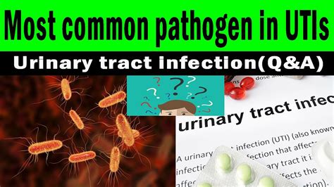 The Most Common Pathogen In Utis Urinary Tract Infectionqanda Youtube