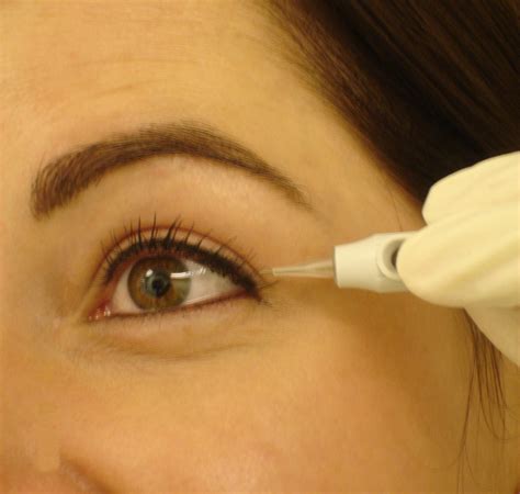 Cumberland Laser Clinic Aesthetics Permanent Makeup