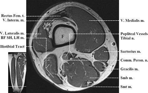 Supplemental Materials For Normal Mr Imaging Anatomy Of The Thigh And