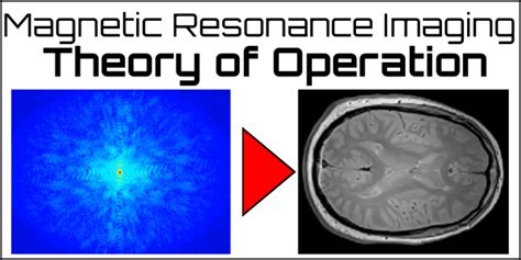 Magnetic Resonance Imaging Oncology Medical Physics