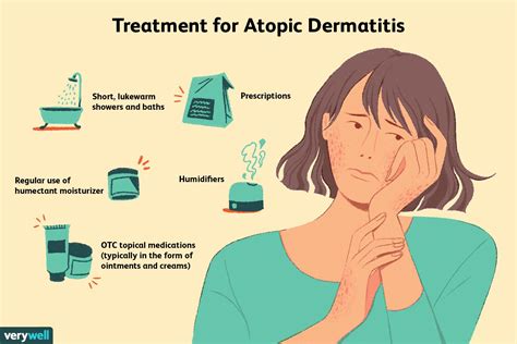 How Atopic Dermatitis Is Treated