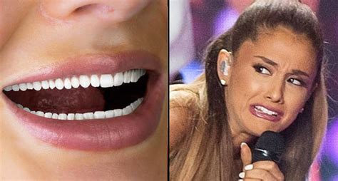 Everyones Seriously Creeped Out By This Terrifying Tooth Whitening