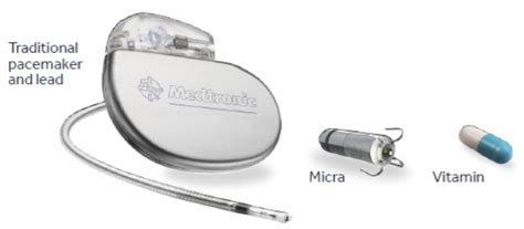 Leadless Pacemaker Systems