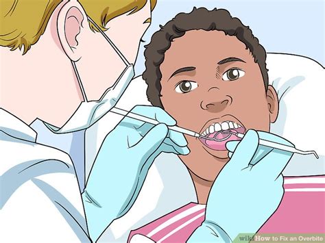 An overbite is no longer correctible with invisalign mandibular advancement once the age of 12 or 13 has been reached. How to Fix an Overbite: 9 Steps (with Pictures) - wikiHow