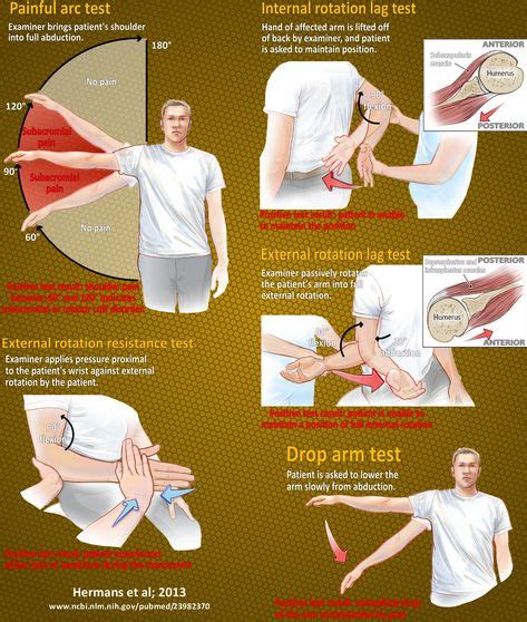 13 Best Shoulder Impingement Syndrome Images Shoulder Impingement