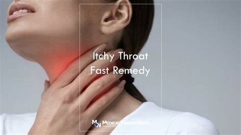 9 Quick Ways To Cure Itchy Throat For Filipinos Medical Trends Now