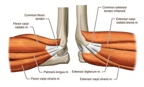 Common Wrist Tendons Orthopedics Gross Anatomy Anatomy