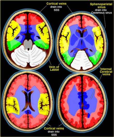 Brain Ischemia Vascular Territories Neurology Brain Diseases Radiology Imaging