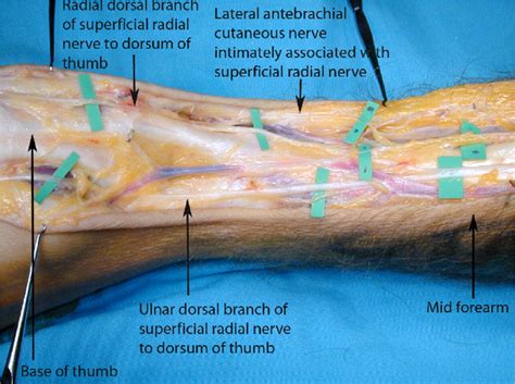 Medial Brachial Cutaneous Nerve