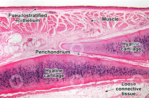 Draw A Labelled Diagram Of The Transverse Section Of The Hyaline