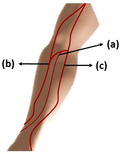 Sensors Free Full Text Vein Pattern Locating Technology For