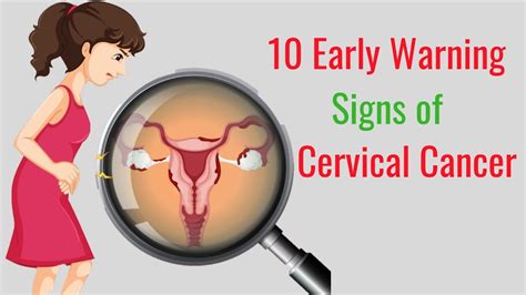 10 Early Warning Signs Of Cervical Cancer You Should Not Ignore Youtube