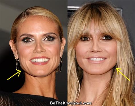 heidi klum before and after