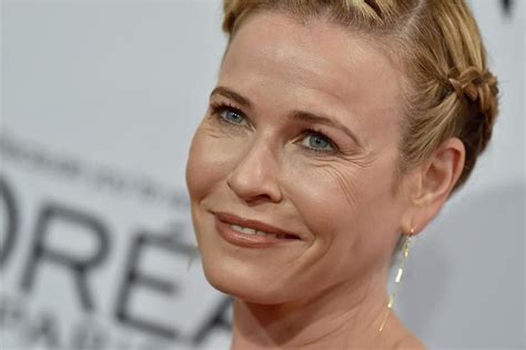 Had A Facelift Lately Chelsea Handler S Frozen Face Exposed Before After Photos