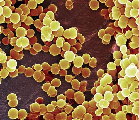 Mrsa is a type of bacteria that's resistant to several widely used antibiotics. MRSA bacteria, SEM - Stock Image - C010/5904 - Science ...