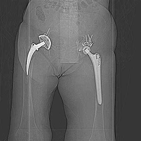 Maybe you would like to learn more about one of these? Cross-sectional anatomy of the thigh, demonstrating the ...