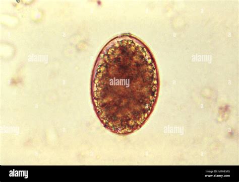 Tapeworm Cestode Parasite Egg Diphyllobothrium Latum Revealed In The