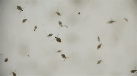 A Colony Of Water Fleas Daphnia Under The Microscope Stock Footage