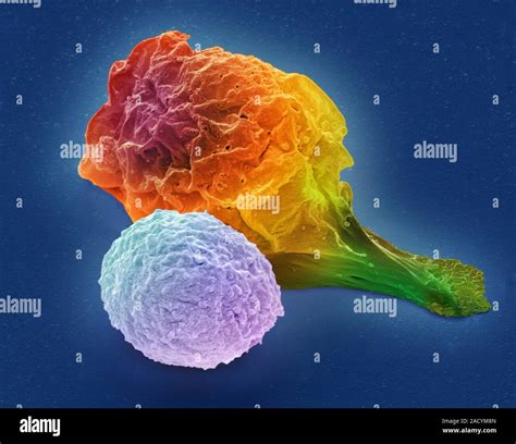 T Lymphocyte And Lymphoma Cancer Cell Coloured Scanning Electron