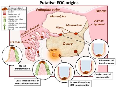 Putative Epithelial Ovarian Cancer Eoc Origins Represented Is A