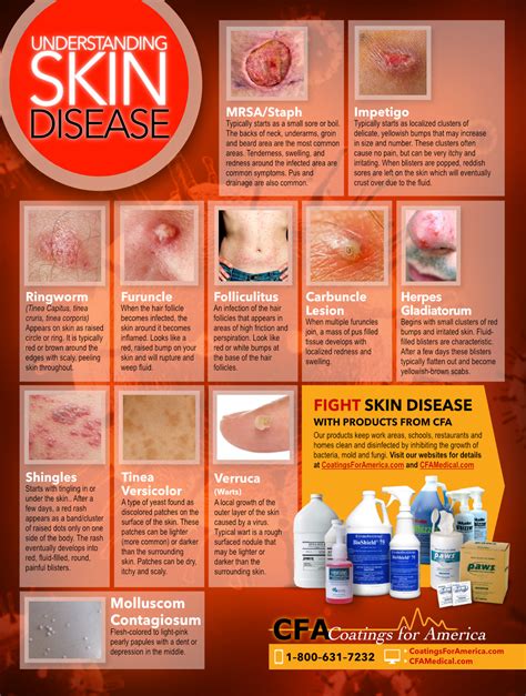 cfa medical understanding skin disease 18 x 24 heavy poster