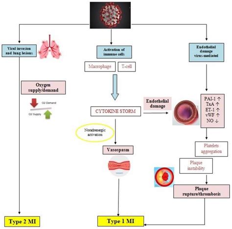 Life Free Full Text Myocardial Ischemia In Patients With Covid 19
