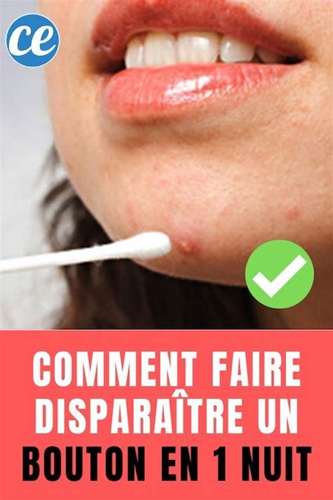 Comment Faire Disparaître Un Bouton En 1 Nuit Skin Care Wrinkles