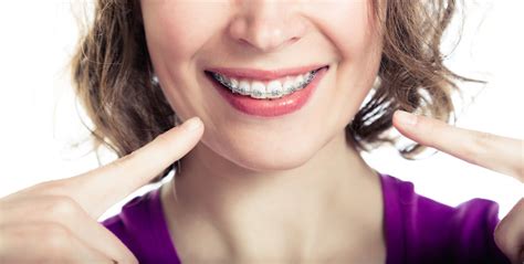 Why Adult Braces Are So Important Belmar Orthodontics