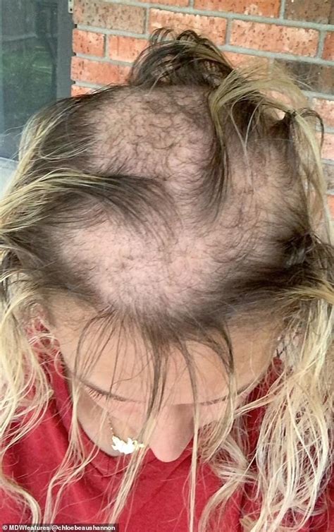 Woman Reveals Shaving Her Head Helped To Overcome Insecurities Daily Mail Online